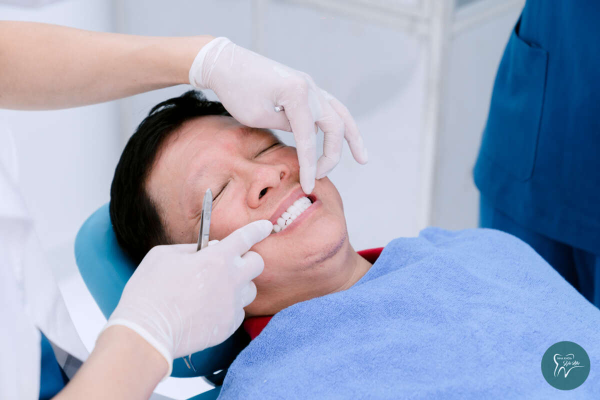 Cấy ghép Implant là phương pháp phục hồi răng bị mất hiệu quả